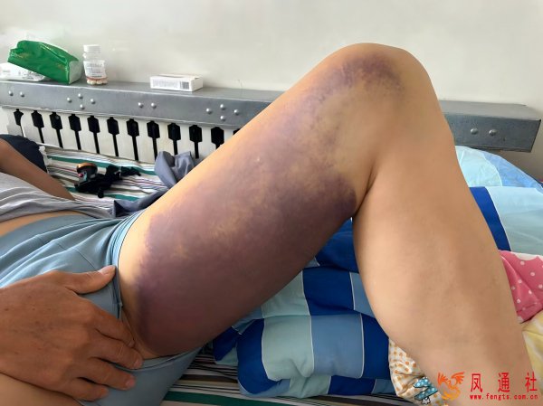 保洁员摔伤后被协议辞退离世 家属讨说法遇企业推诿